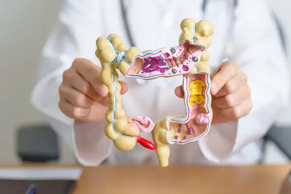 IBS & IBD Treatment