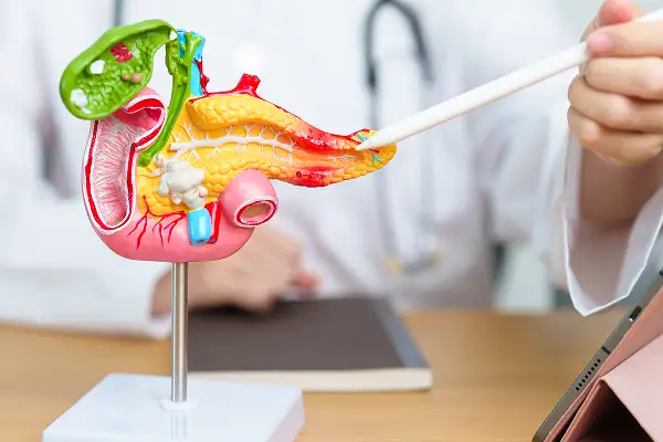 Pancreatitis Treatment